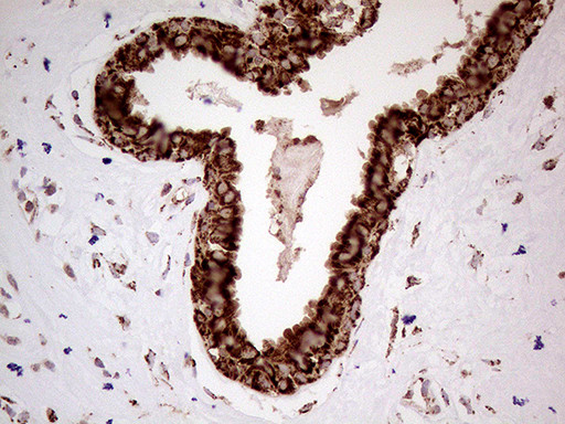 SHMT2 Antibody in Immunohistochemistry (Paraffin) (IHC (P))