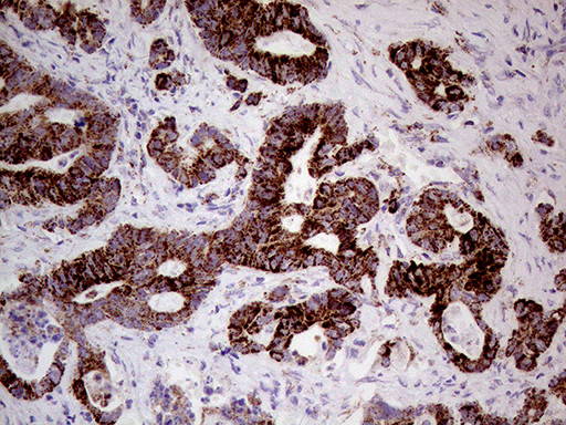 SHMT2 Antibody in Immunohistochemistry (Paraffin) (IHC (P))