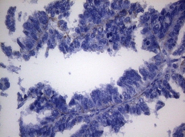 SHMT2 Antibody in Immunohistochemistry (Paraffin) (IHC (P))