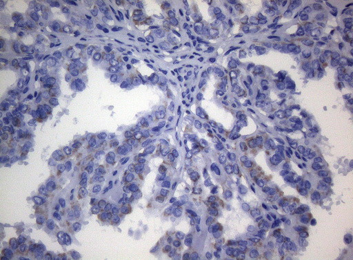 SHMT2 Antibody in Immunohistochemistry (Paraffin) (IHC (P))