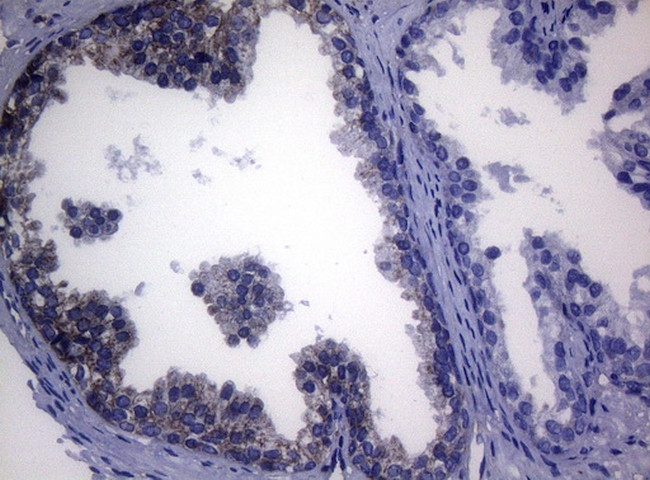 SHMT2 Antibody in Immunohistochemistry (Paraffin) (IHC (P))