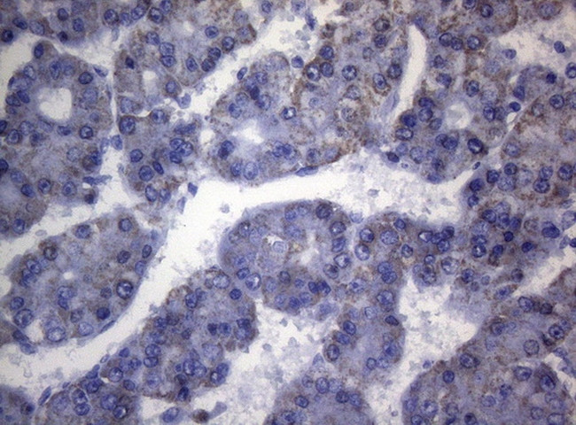 SHMT2 Antibody in Immunohistochemistry (Paraffin) (IHC (P))