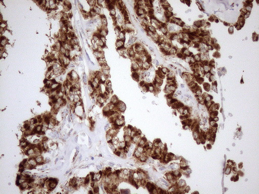 SHMT2 Antibody in Immunohistochemistry (Paraffin) (IHC (P))