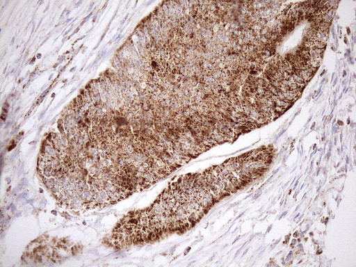 SHMT2 Antibody in Immunohistochemistry (Paraffin) (IHC (P))