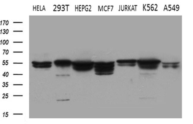 SHMT2 Antibody in Western Blot (WB)