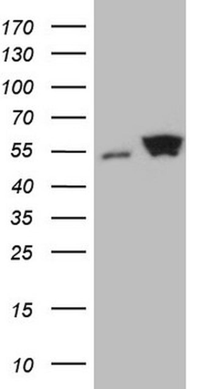 SHMT2 Antibody in Western Blot (WB)