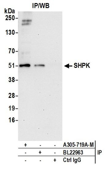 SHPK Antibody in Immunoprecipitation (IP)