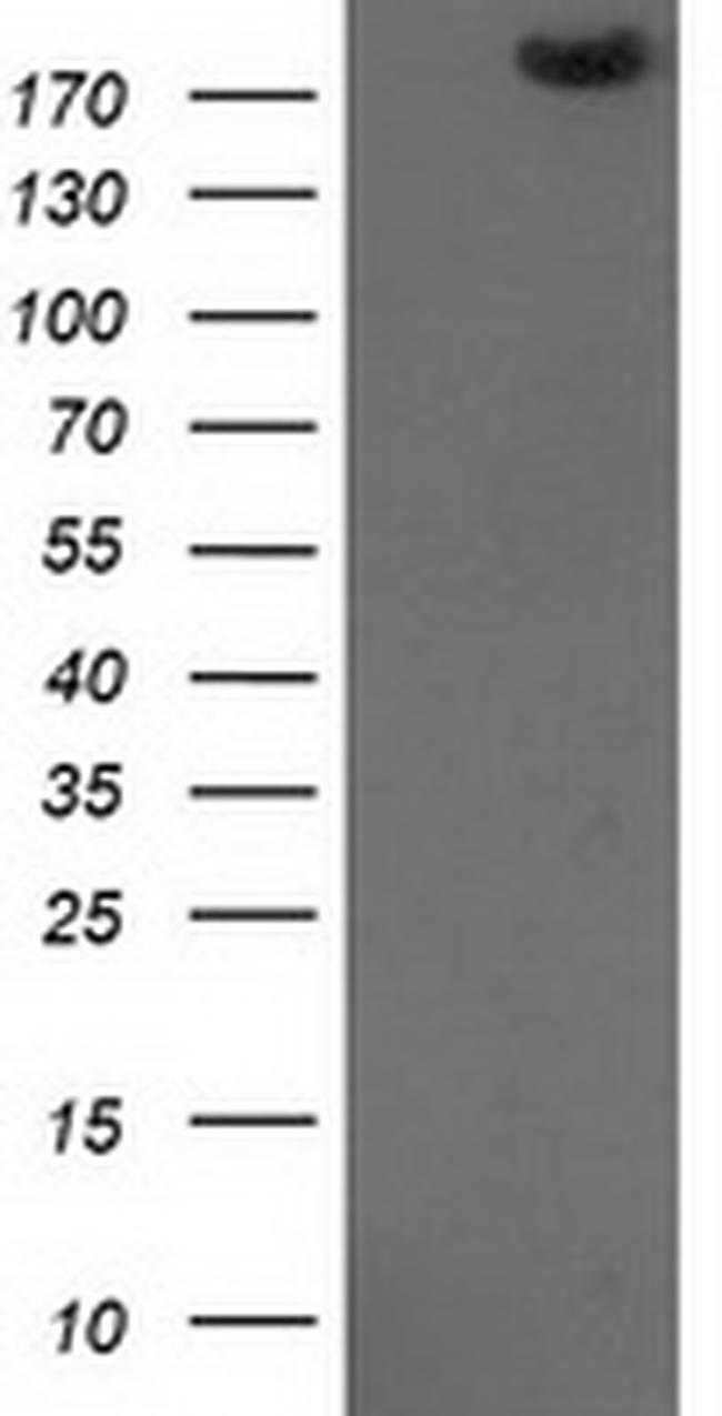 SHPRH Antibody in Western Blot (WB)