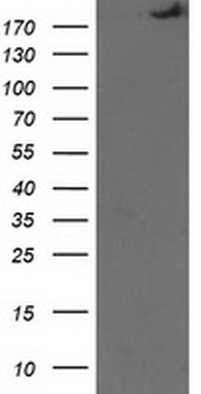 SHPRH Antibody in Western Blot (WB)