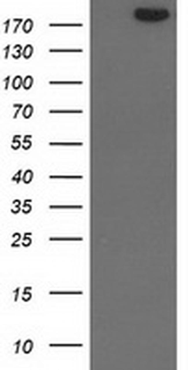 SHPRH Antibody in Western Blot (WB)