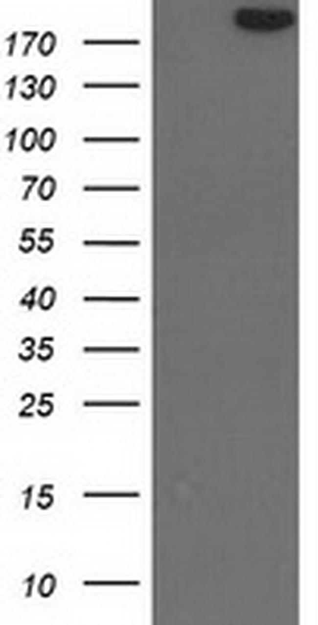 SHPRH Antibody in Western Blot (WB)