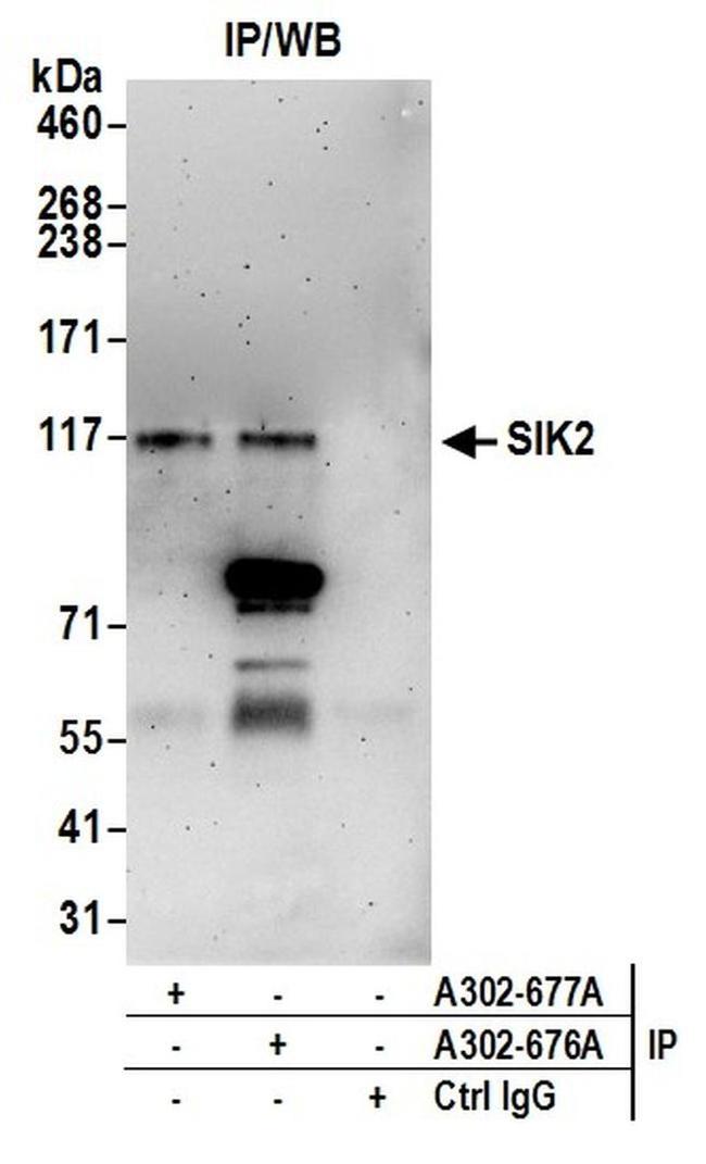 SIK2 Antibody in Western Blot (WB)