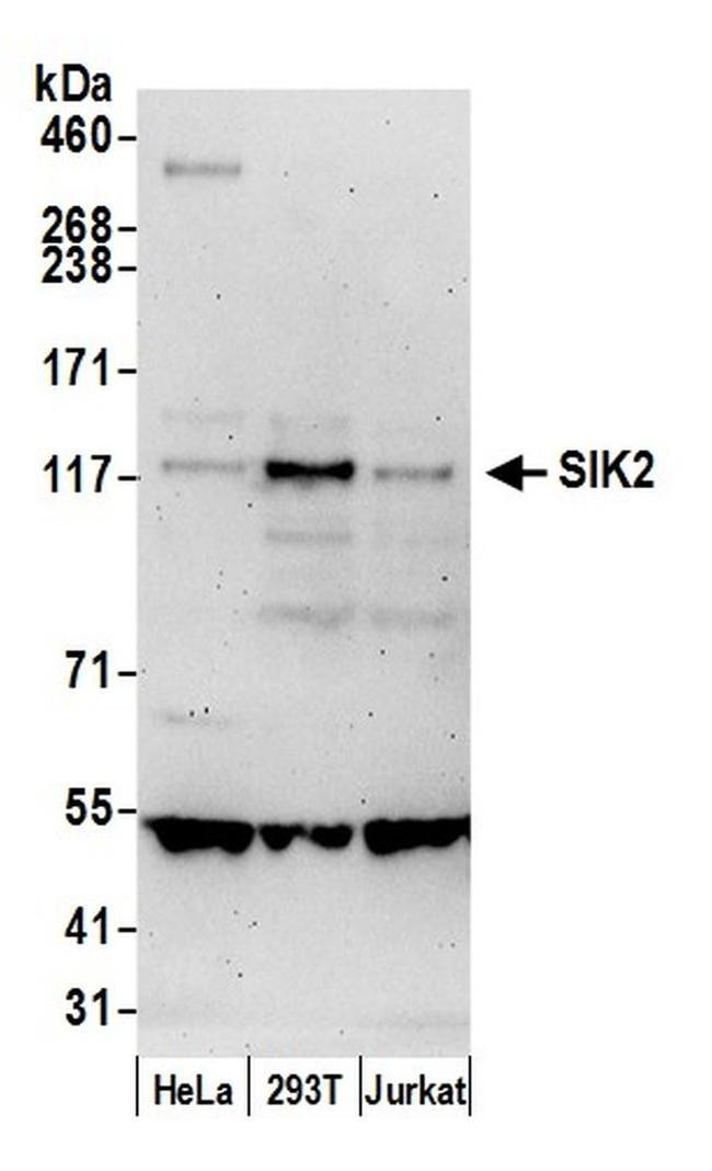 SIK2 Antibody in Western Blot (WB)