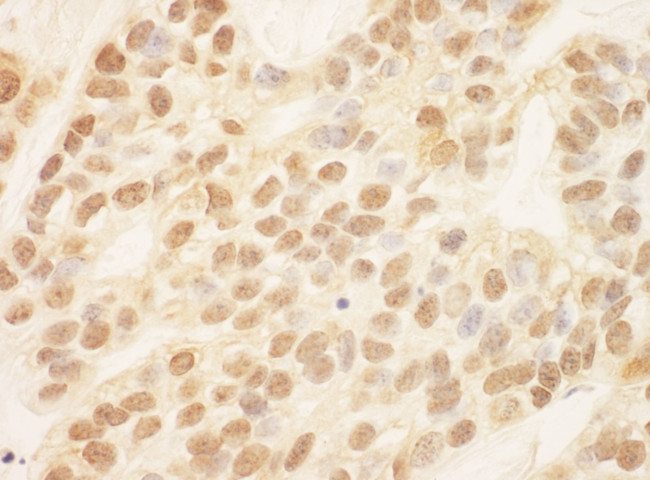 SIP1 Antibody in Immunohistochemistry (IHC)