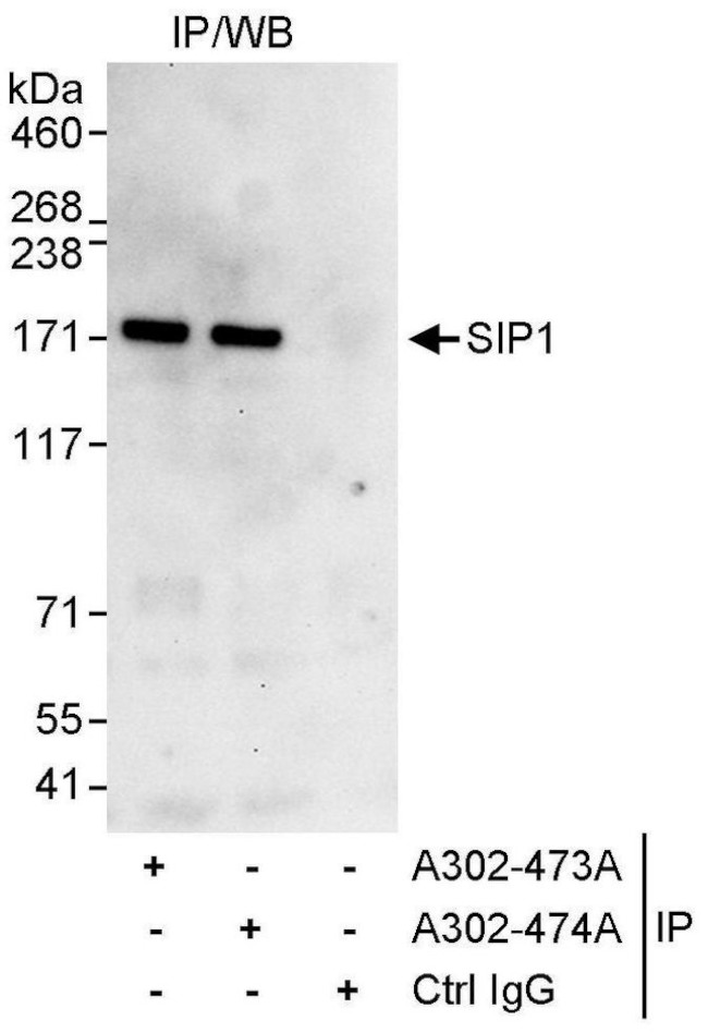 SIP1 Antibody in Immunoprecipitation (IP)