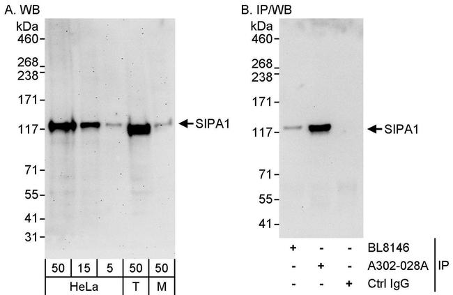 SIPA1 Antibody in Western Blot (WB)