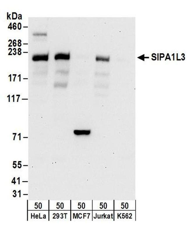 SIPA1L3 Antibody in Western Blot (WB)