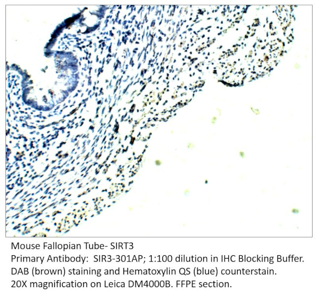 SIRT3 Antibody in Immunohistochemistry (IHC)