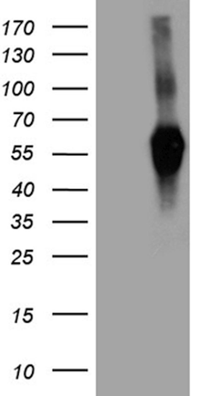 SIRPB1 Antibody in Western Blot (WB)