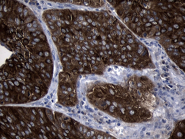 SIRT1 Antibody in Immunohistochemistry (Paraffin) (IHC (P))