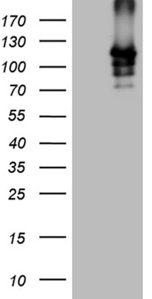 SIRT1 Antibody in Western Blot (WB)