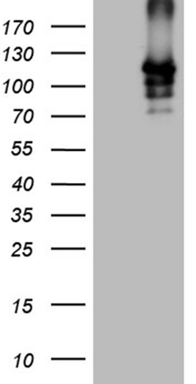 SIRT1 Antibody in Western Blot (WB)