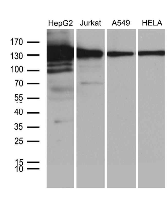 SIRT1 Antibody in Western Blot (WB)