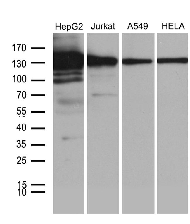 SIRT1 Antibody in Western Blot (WB)