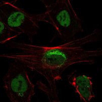 SIRT1 Antibody in Immunocytochemistry (ICC/IF)