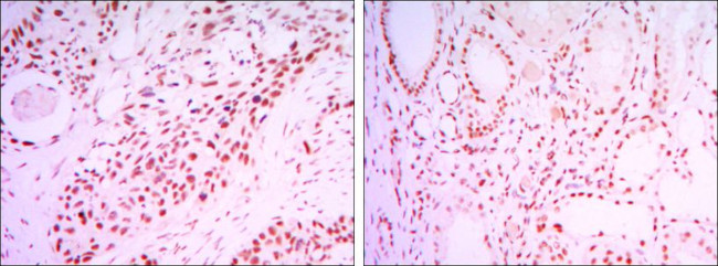 SIRT1 Antibody in Immunohistochemistry (Paraffin) (IHC (P))