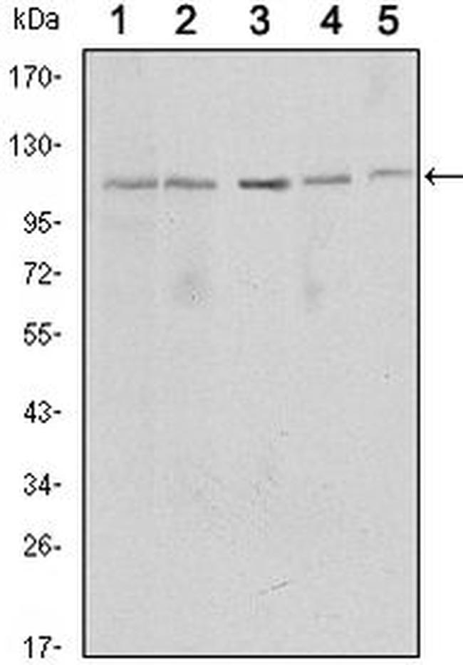 SIRT1 Antibody in Western Blot (WB)