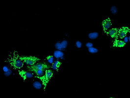 SIRT5 Antibody in Immunocytochemistry (ICC/IF)