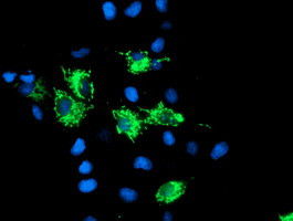 SIRT5 Antibody in Immunocytochemistry (ICC/IF)