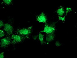 SIRT5 Antibody in Immunocytochemistry (ICC/IF)