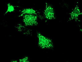 SIRT5 Antibody in Immunocytochemistry (ICC/IF)