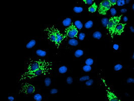 SIRT5 Antibody in Immunocytochemistry (ICC/IF)