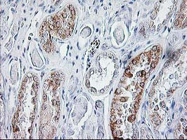 SIRT5 Antibody in Immunohistochemistry (Paraffin) (IHC (P))