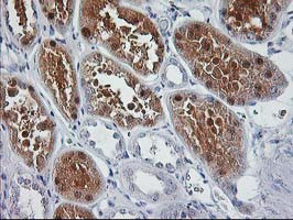 SIRT5 Antibody in Immunohistochemistry (Paraffin) (IHC (P))