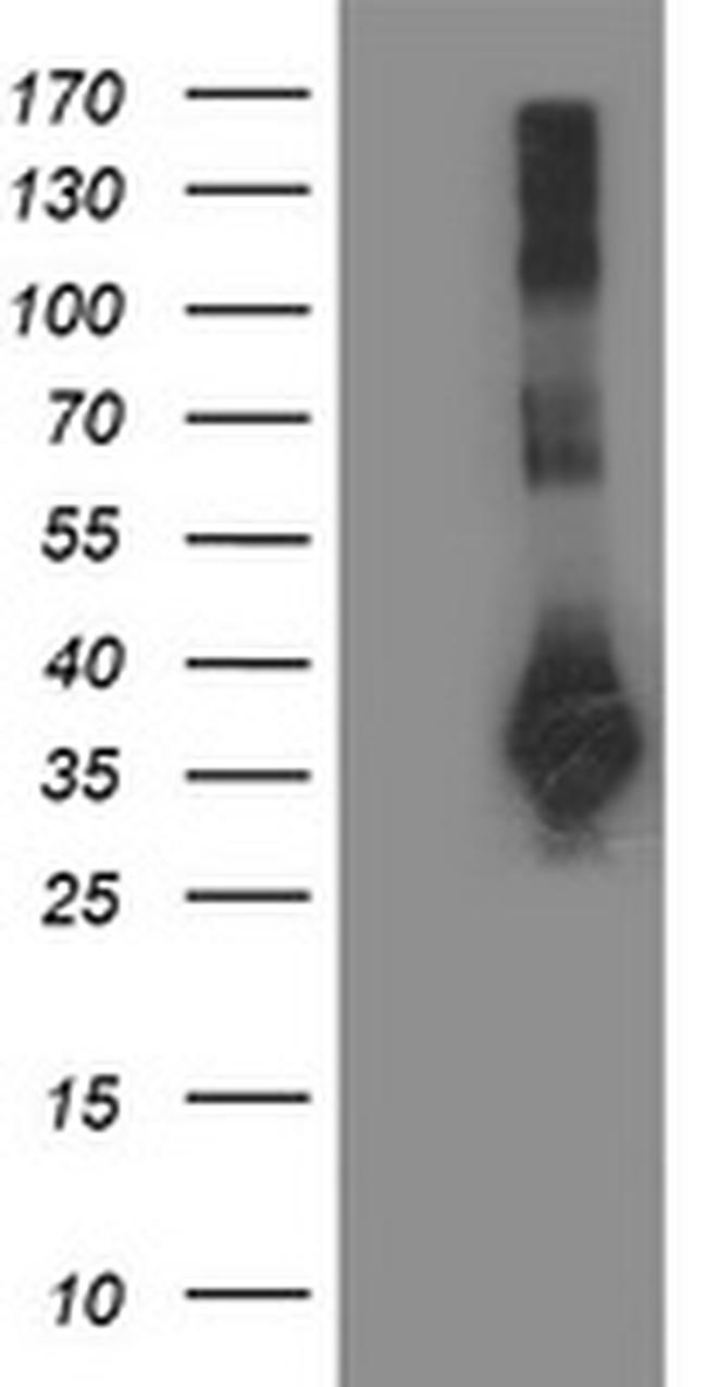 SIRT5 Antibody in Western Blot (WB)