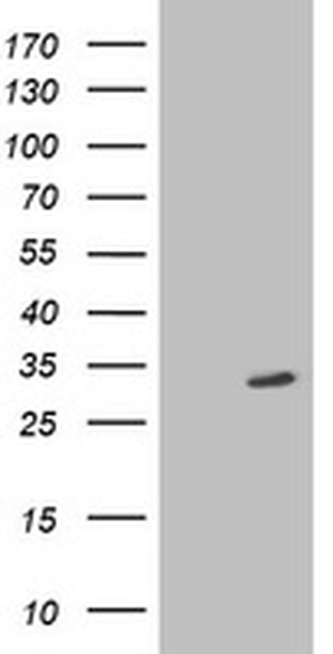 SIRT5 Antibody in Western Blot (WB)