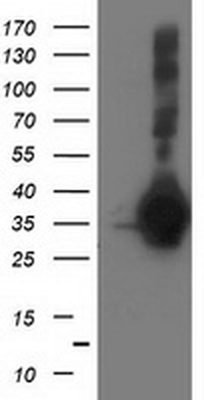 SIRT5 Antibody in Western Blot (WB)