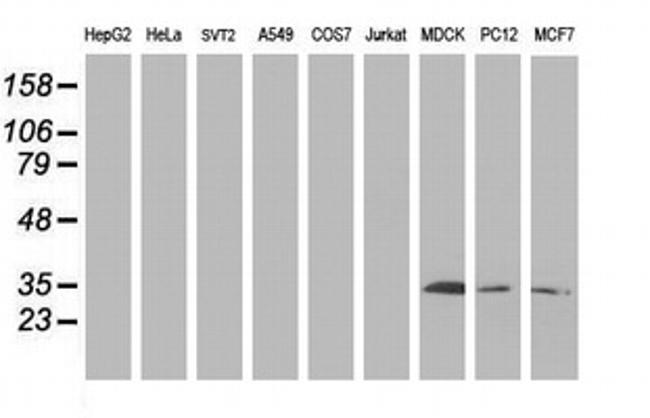 SIRT5 Antibody in Western Blot (WB)