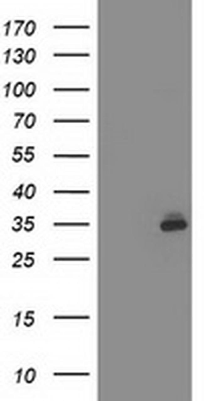 SIRT5 Antibody in Western Blot (WB)