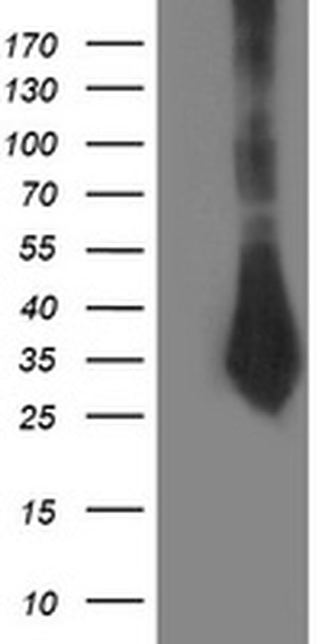 SIRT5 Antibody in Western Blot (WB)