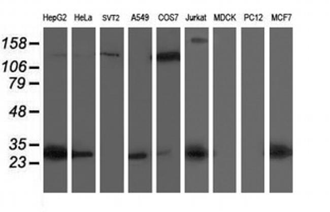 SIRT5 Antibody in Western Blot (WB)