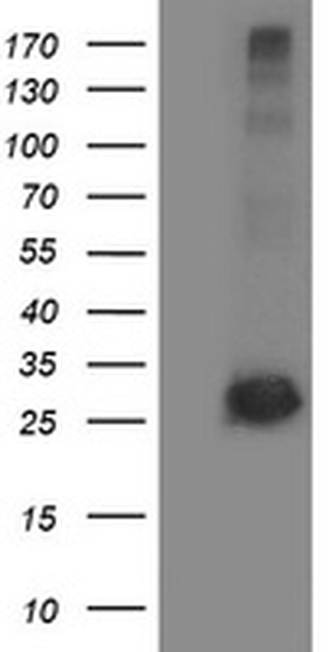 SIRT5 Antibody in Western Blot (WB)