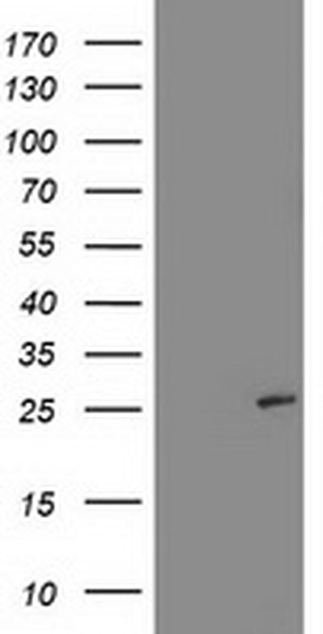 SIRT5 Antibody in Western Blot (WB)