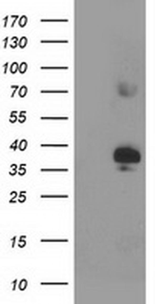 SIRT6 Antibody in Western Blot (WB)