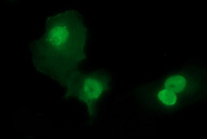 SIVA1 Antibody in Immunocytochemistry (ICC/IF)