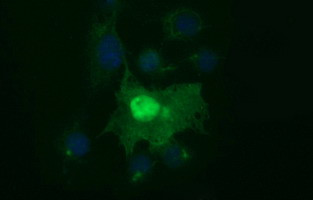 SIVA1 Antibody in Immunocytochemistry (ICC/IF)